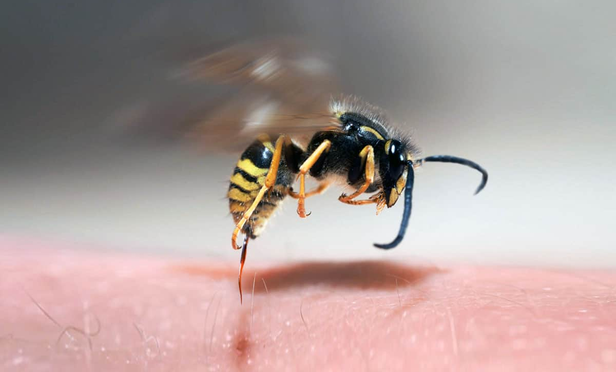 Picadura de abeja [Foto: AvantiaSalud]