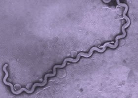Vista al microscopio con tinción de plata de una Leptospira. [Imagen: La Guia - Biología]