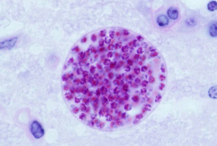 Toxoplasma gondii. [Imagen: Radio el Microscopio / Info Bioquímica]