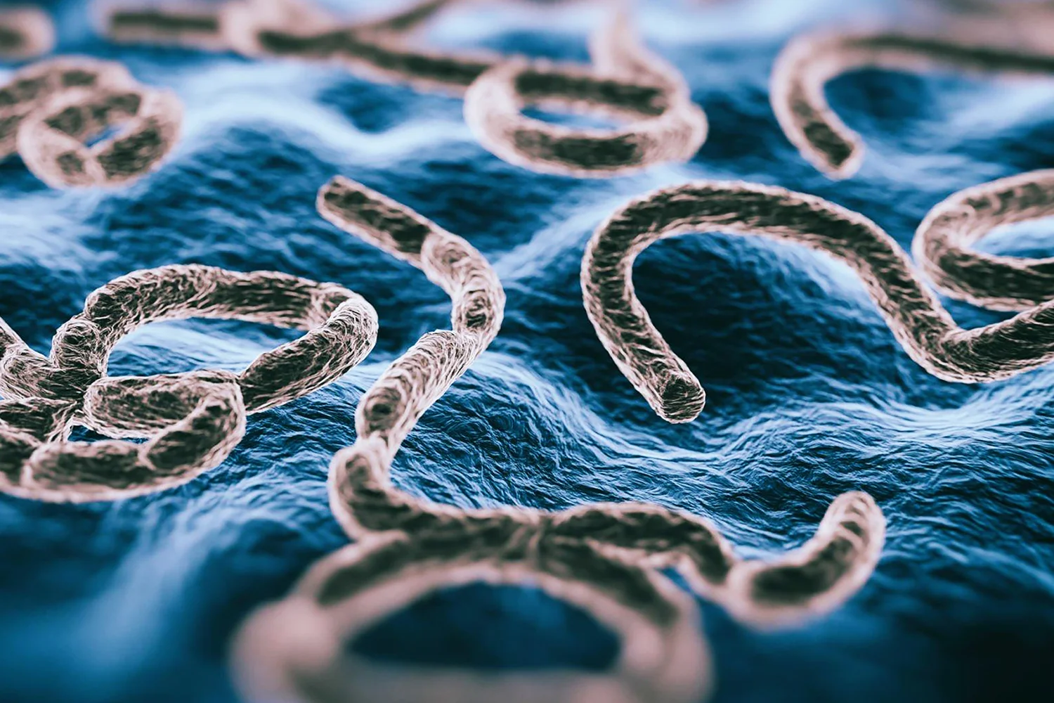 Triquinosis. [Imagen: Hospital Clínica Asturias]